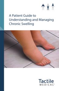 Understanding and Managing Chronic Swelling