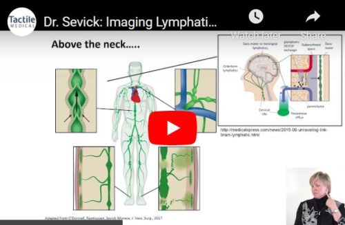 Imaging Lymphatic Function in Head and Neck Cancer Patients - Tactile ...