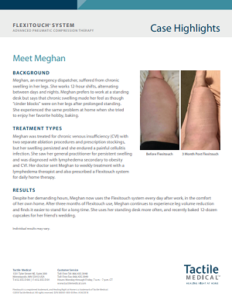 Meet Meghan - Case highlights from a women with leg lymphedema