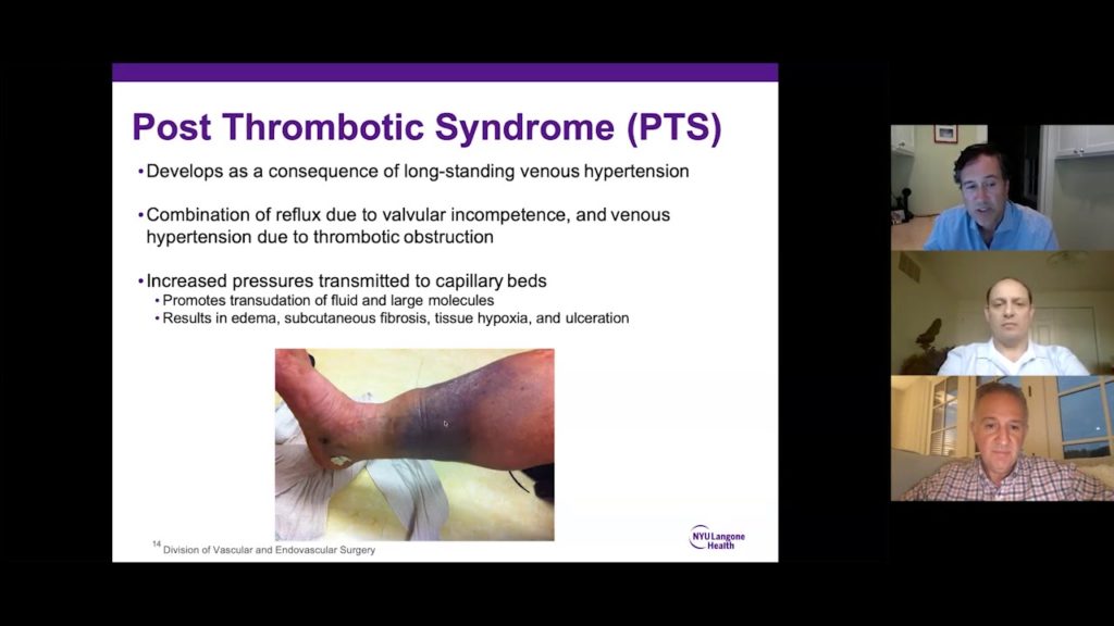 Current lymphedema resources clinician learning opportuities
