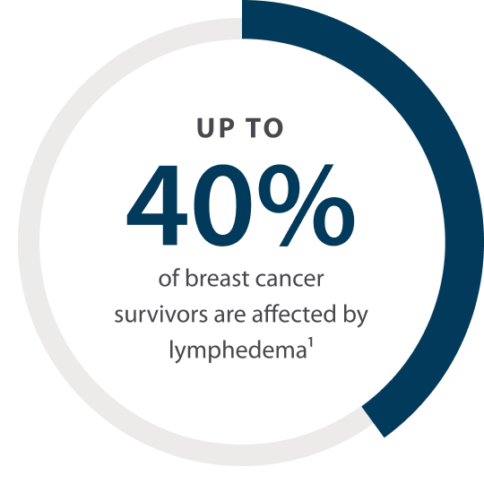 up to 40% of breast cancer survivors are affected by lymphedema
