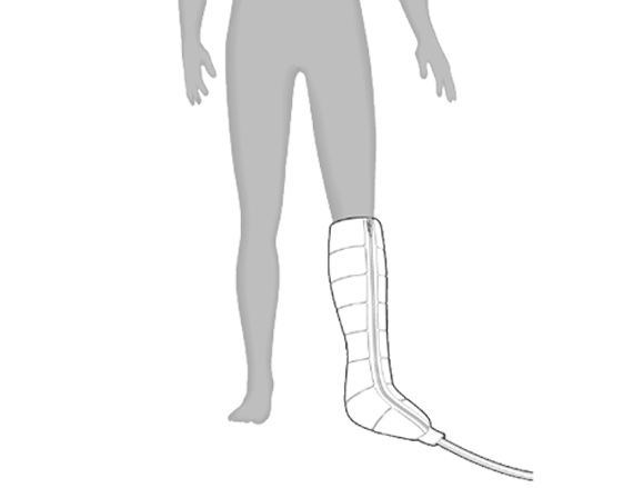 Entre for Lower Body Lymphedema graphic