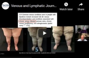 Venous and Lymphatic Journal Club December 2021