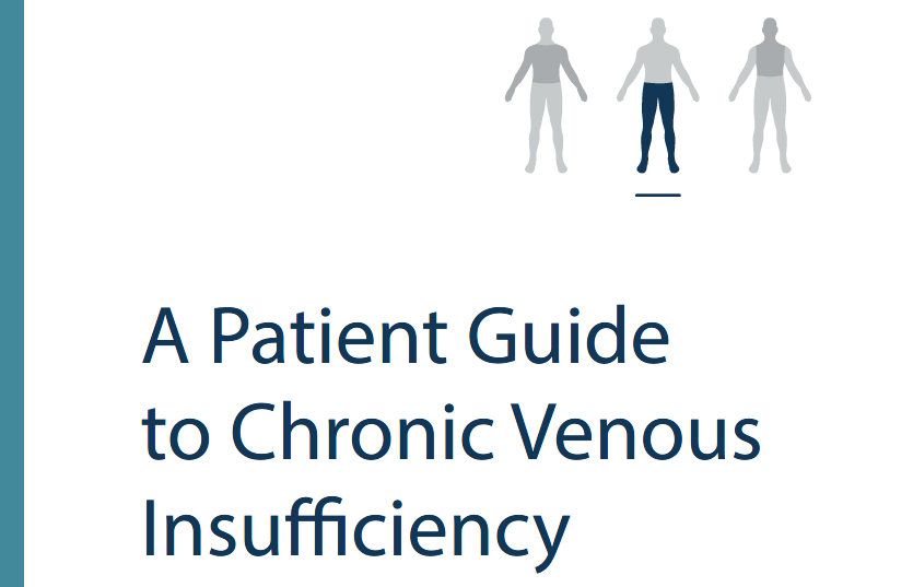 A patient guide to chronic venous insufficiency thumbnail