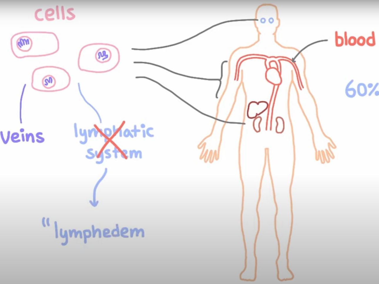 lymphedema explained