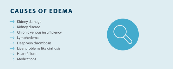 causes of edema