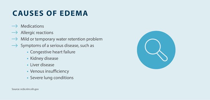 causes of edema, can include: medications, allergic reactions, mild or temporary water retention problem, symptoms of a serious disease such as: congestive heart failure, kidney disease, liver disease, venous insufficiency, severe lung conditions