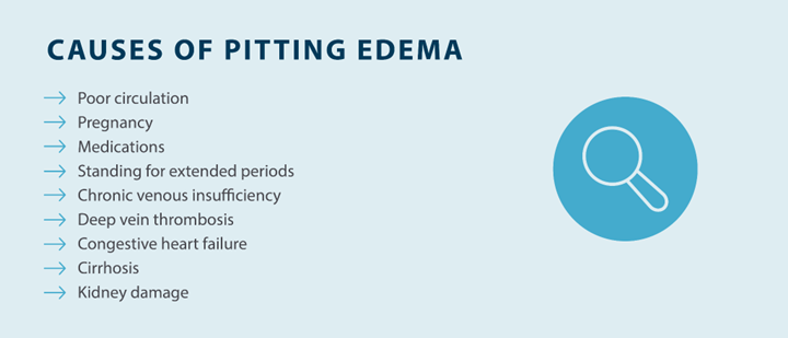 causes of pitting edema; poor circulation, pregnancy, medications, standing for extended periods, chronic venous insufficiency, deep vein thrombosis, congestive heart failure, cirrhosis, kidney damage