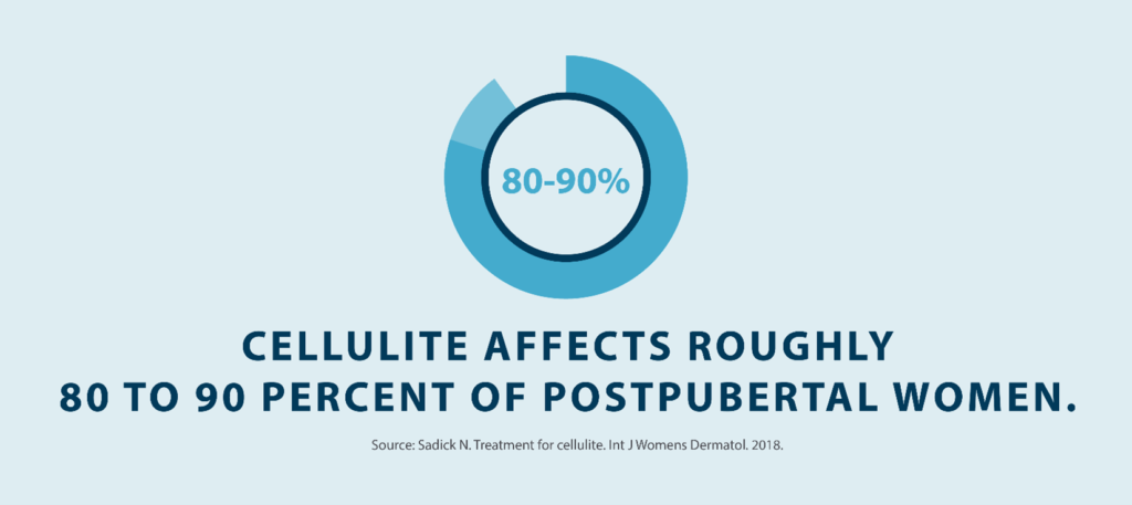 cellulite affects roughly 80 - 90 percent of postpubertal women Source Sadick N. Treatment for cellulite Int J Womens Dermatol
