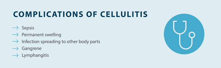 complications of cellulitis