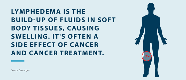 Lymphedema is the build-up of fluids in soft body tissues, causing swelling. it's often a side effect of cancer and cancer treatment Source Cancer.org