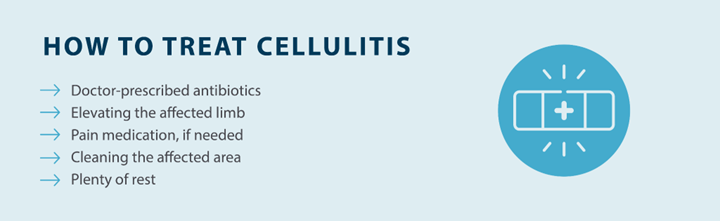 how to treat cellulitis; doctor-prescribed antibiotics, elevating the affected limb, pain medication, cleaning the affected area, plenty of rest