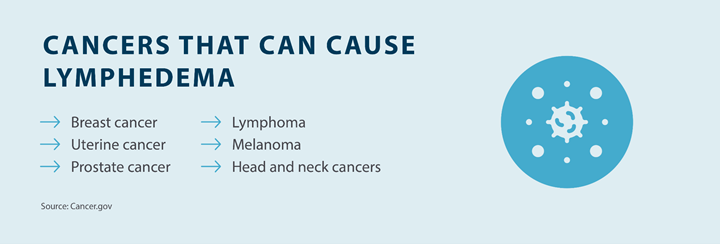 cancers that can cause lymphedema; breast cancer, uterine cancer, prostate cancer, lymphoma, melanoma, head and neck cancers