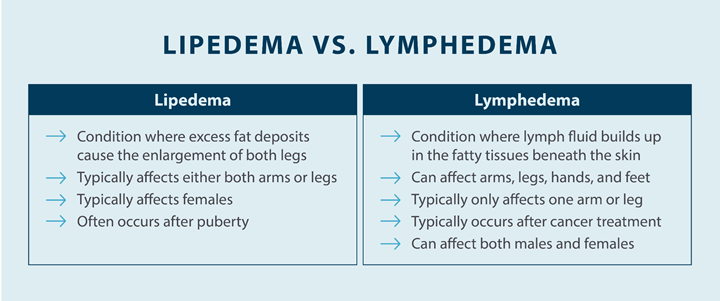 image showing lipedema versus lymphedema symptoms