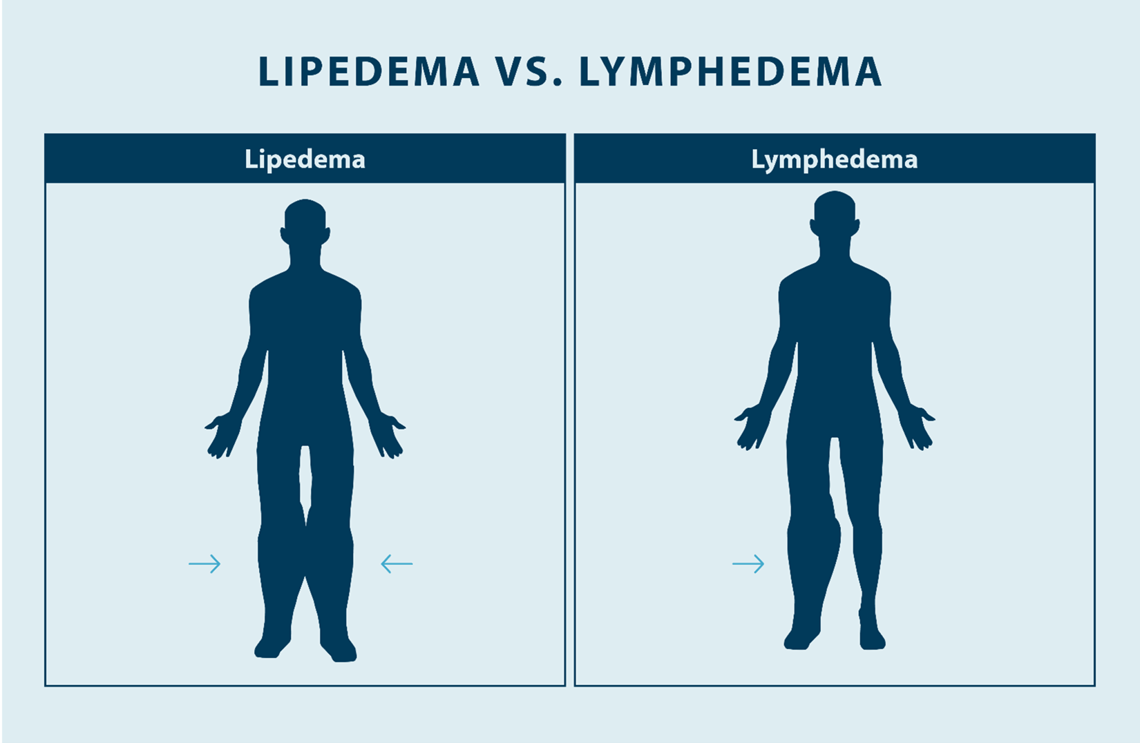 image showing lipedema versus lymphedema