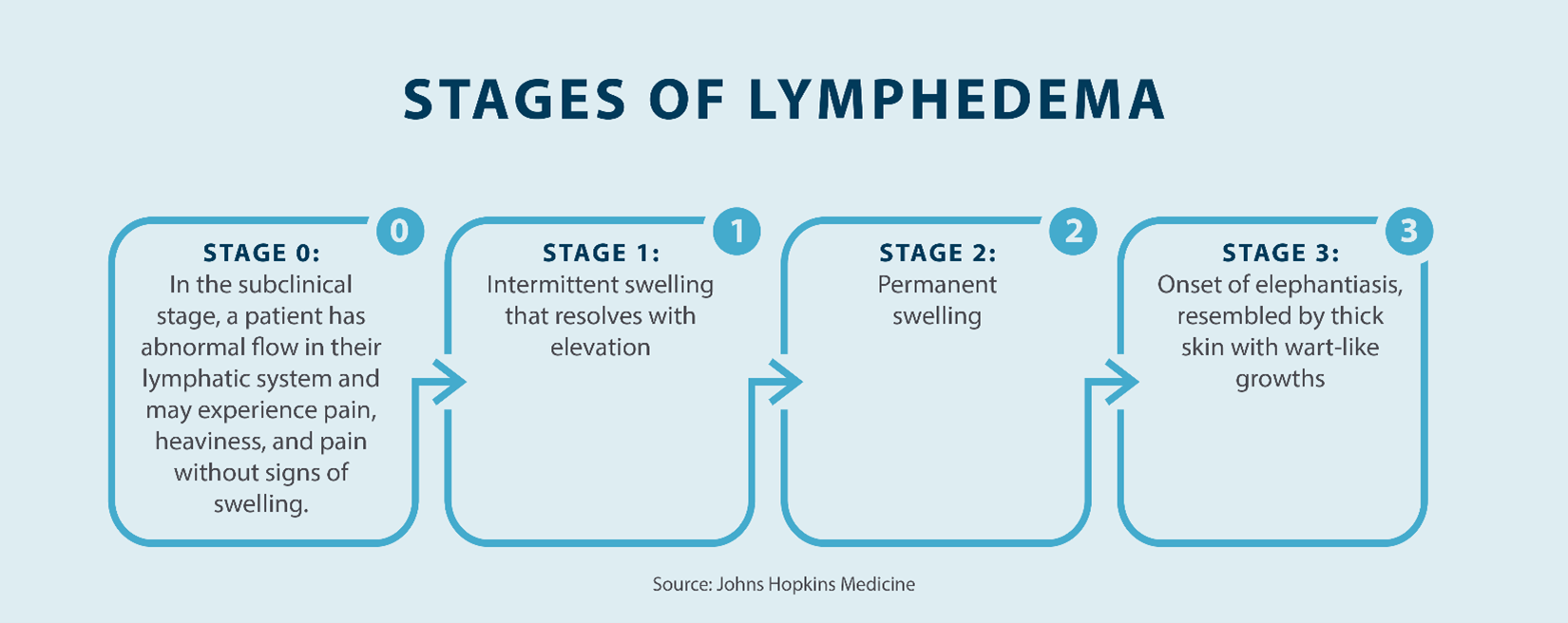 the stages of lymphedema; stage 0, stage 1, stage 2, stage 3 Source John Hopkins Medicine