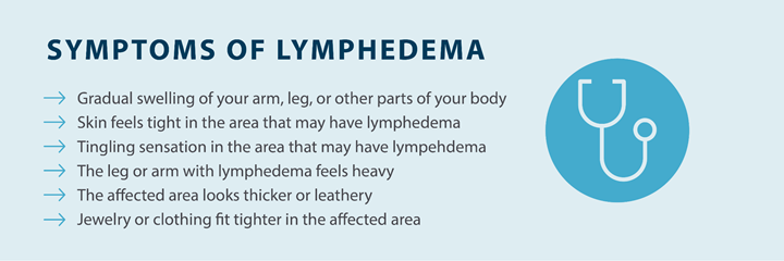 image showing the symptoms of lymphedema