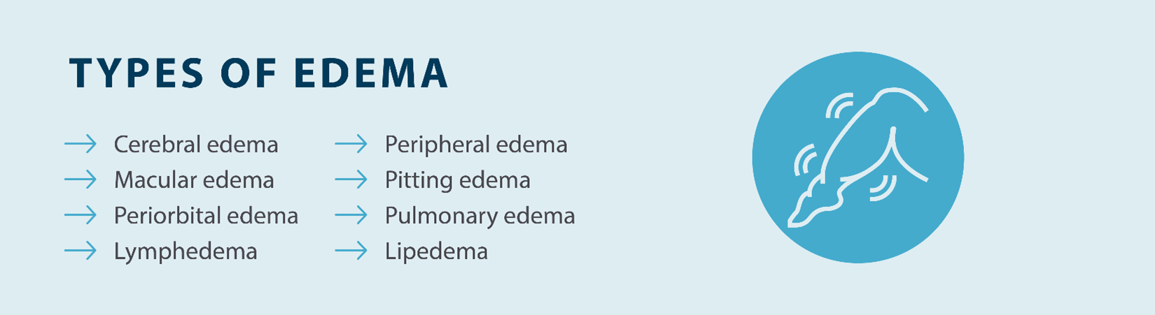 types of edema: cerebral edema, macular edema, periorbital edema, lymphedema, peripheral edema, pitting edema, pulmonary edema, lipedema