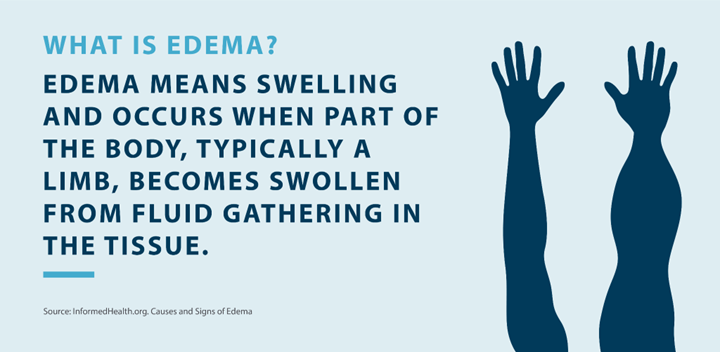 what is edema; edema means swelling and occurs when part of the body, typically a limb, becomes swollen from fluid gathering in the tissue Source InformedHealth.org - Causes and Signs of Edema
