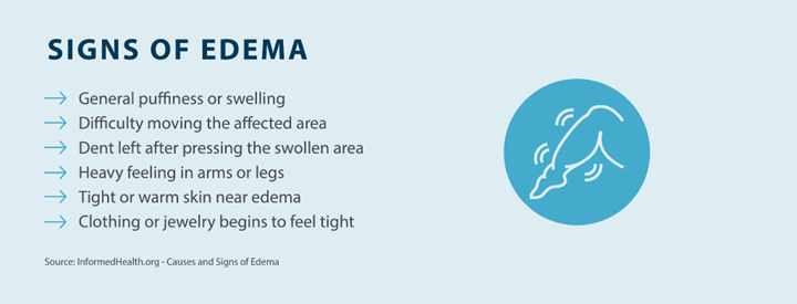 signs of edema; general puffiness or welling, difficulty moving the affected area, dent left after pressing the swollen area, heavy feeling in arms or legs, tight or warm skin near edema, clothing or jewelry begins to feel tight Source InformedHealth.org - Causes and Signs of Edema
