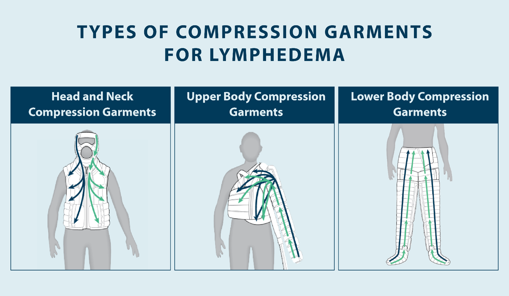 types of compression garments for lymphedema: head and neck compression garments, upper body compression garments, lower body compression garments