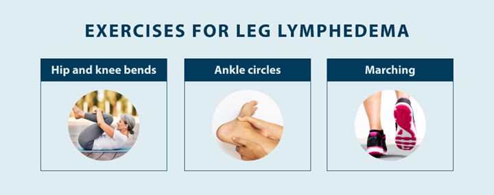 exercises for leg lymphedema: hip and knee bends, ankle circles, marching