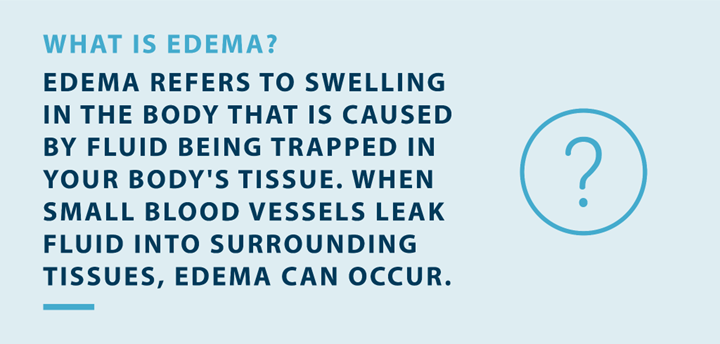 what is edema? edema refers to swelling in the body that is caused by fluid being trapped in your bodys tissues. when small blood vessels leak fluid into surrounding tissues edema can occur