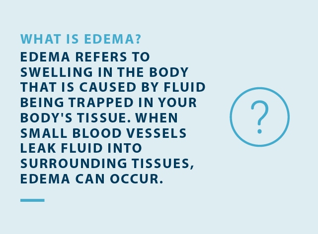what is edema? edema refers to swelling in the body that is caused by fluid being trapped in your bodys tissue. when small blood vessels leak fluid into surrounding tissues edema can occur