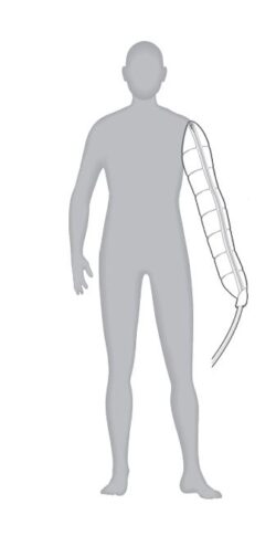 illustration of the Entre Plus upper extremity garment