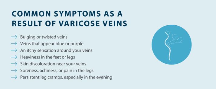 common symptoms as a result of varicose veins