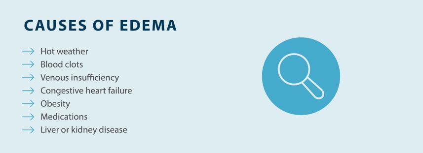Causes of edema