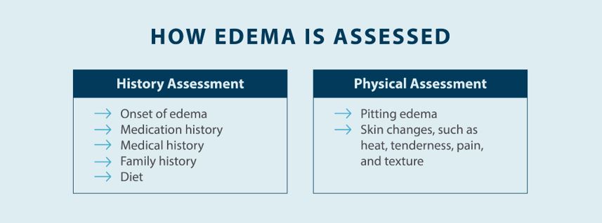How edema is assessed 