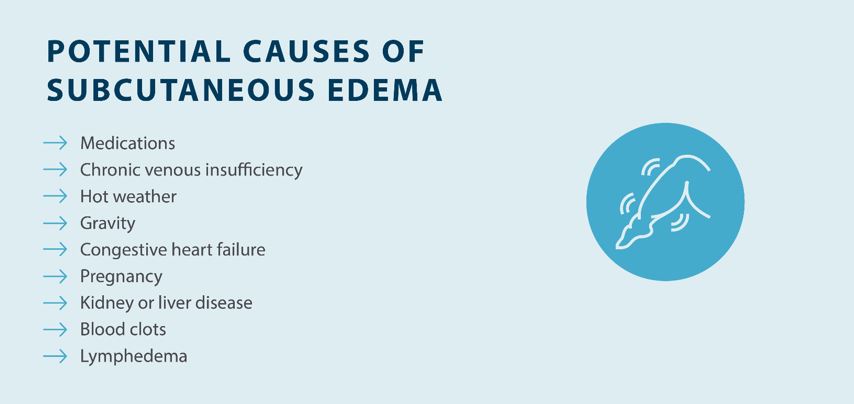 potential causes of subcutaneous edema
