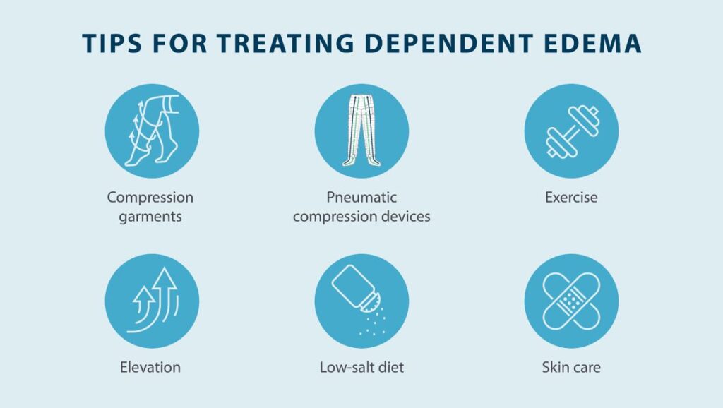 tips for treating dependent edema