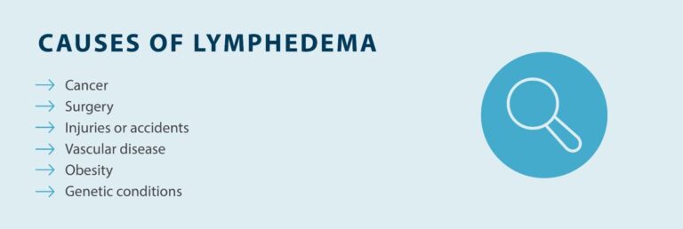 Lymphedema Self Treatment: How to Care for Lymphedema at Home - Tactile ...