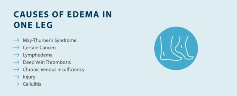 Edema in One Leg: What Causes Swelling in One Leg Only? - Tactile Medical