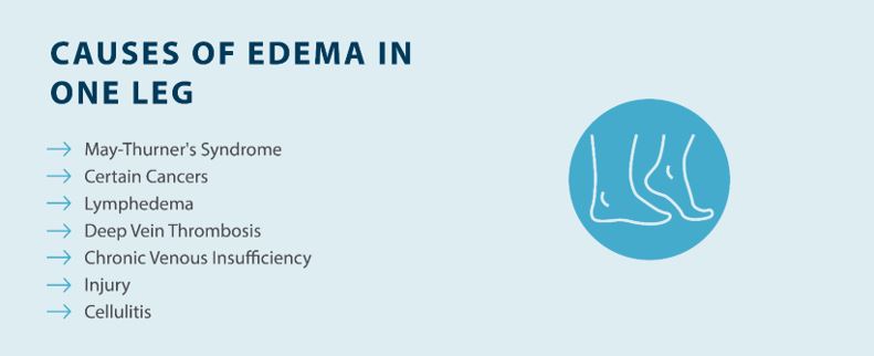 CAUSES OF EDEMA IN ONE LEG
—> May-Thurner's Syndrome —> Certain Cancers —> Lymphedema —> Deep Vein Thrombosis —> Chronic Venous Insufficiency —> Injury —> Cellulitis