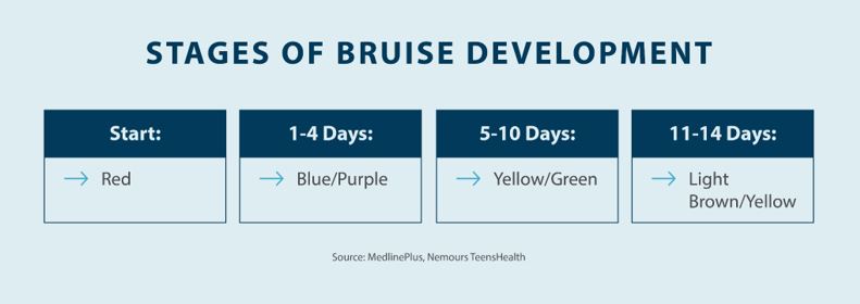 STAGES OF BRUISE DEVELOPMENT
Start:Red 1-4 Days:Blue/Purple 5-10 Days: Yellow/ Green	11-14 Days: Light Brown/Yellow