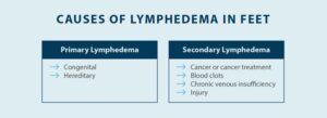 Lymphedema in Feet: Causes, Symptoms & Treatment - Tactile Medical