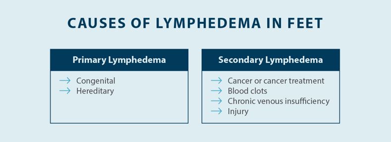 causes of lymphedema in feet, primary lymphema and secondary lymphedema