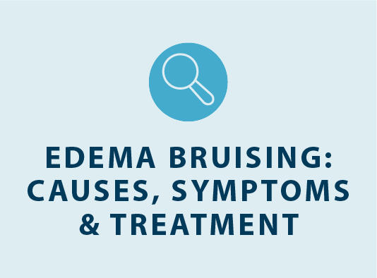 edema bruising causes symptoms and treatment