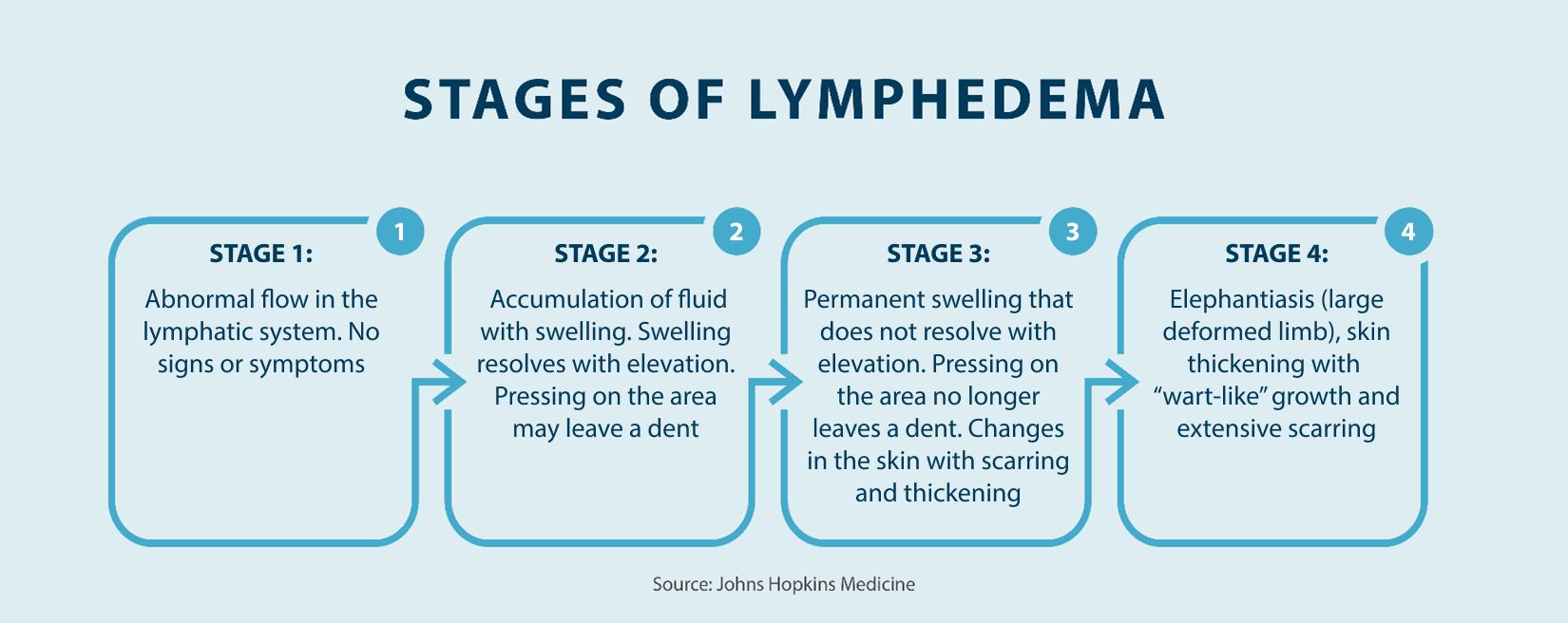 Stage 1: Abnormal flow in the lymphatic system. No signs or symptoms; Stage 2: Accumulation of fluid with swelling. Swelling resolves with elevation. Pressing on the area may leave a dent; Stage 3: Permanent swelling that does not resolve with elevation. Pressing on the area no longer leaves a dent. Changes in the skin with scarring and thickening; Stage 4: Elephantiasis (large deformed limb), skin thickening with “wart-like” growth and extensive scarring  Source John Hopkins Medicine