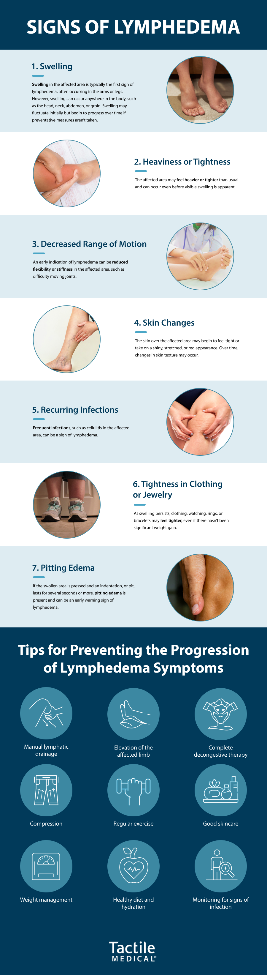 Signs of Lymphedema infographic