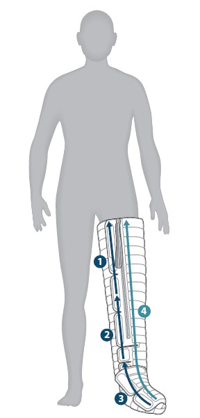 L4-CL4 Unilateral Illustration