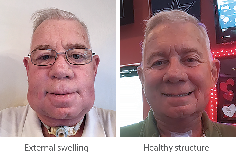 external swelling and healthy structure