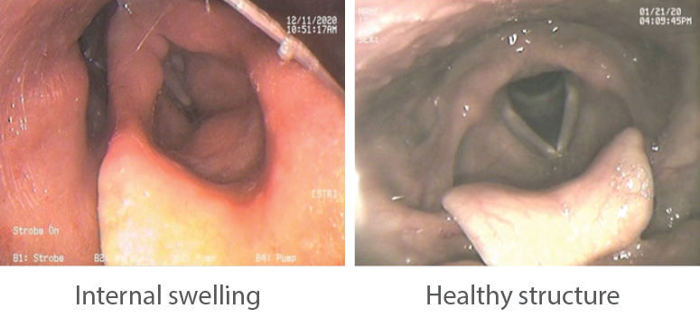 internal swelling and healthy structure