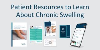 Patient Resources to Learn About Chronic Swelling