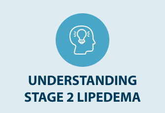Stage 2 Lipedema