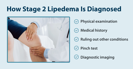 How Stage 2 Lipedema Is Diagnosed -Physical examination -Medical history -Ruling out other conditions -Pinch test -Diagnostic imaging