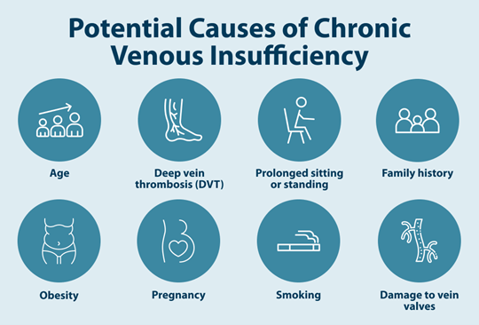 potential causes of venous insufficiency